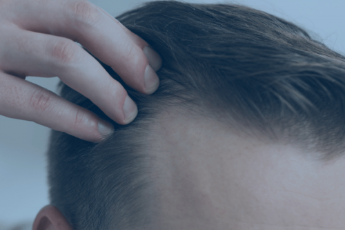 Consulta tricología