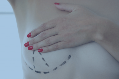 Consulta cirugía plástica