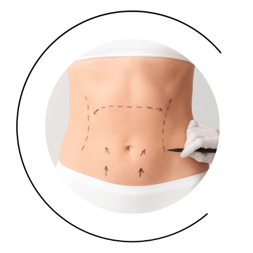 abdominoplastia oviedo asturias