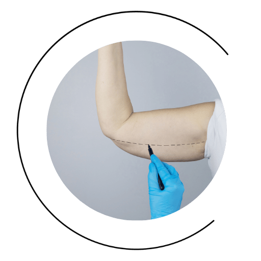 lifting de brazos asturias oviedo